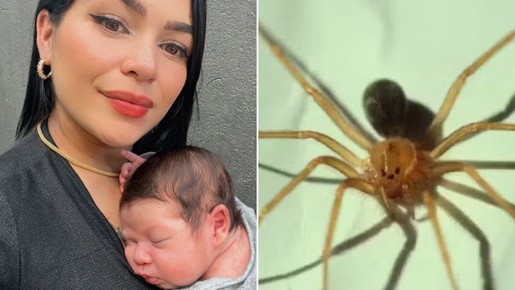 Grávida picada por aranha venenosa e que teve a pele necrosada dá à luz: 'Saudável' 