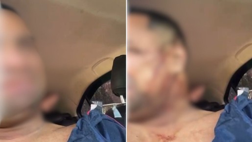 Motorista de app faz vídeo após ser baleado em sequestro no litoral de SP; veja