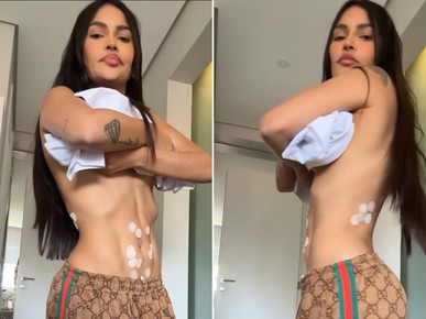 Flay mostra abdômen após procedimento contra 'gordurinha': 'Toda furada'; vídeo