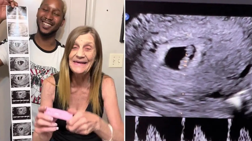 Famoso nas redes, casal que tem 37 anos de diferença anuncia bebê por barriga de aluguel
