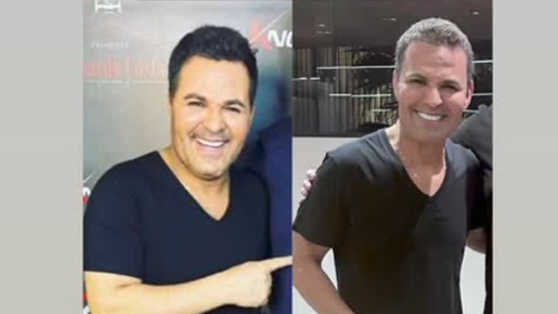 Esposa compara fotos de Eduardo Costa após cantor perder 21kg; confira