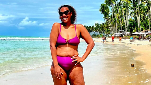 Luana Xavier festeja resultado da bariátrica após perder 55 quilos: ‘Vontade de viver’