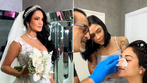 Maquiadora viraliza ao aplicar prótese de nariz em noiva que passou por cirurgia malsucedida